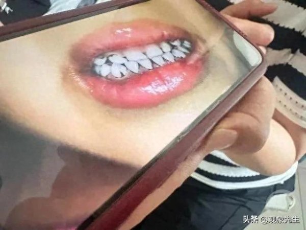 奇点财富 天水幼儿铅中毒后续：官方通报，三疑问待揭秘，家长近乎崩溃！